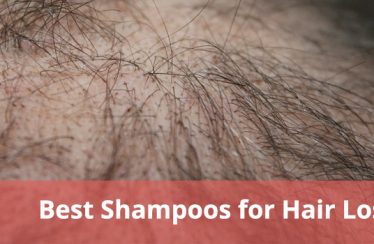 best-shampoos-for-hair-loss