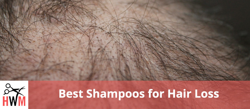 10 Best Shampoos for Hair Loss