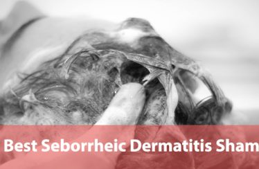 Best-Seborrheic-Dermatitis-Shampoos