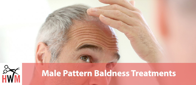 9 Most Effective Male Pattern Baldness Treatments