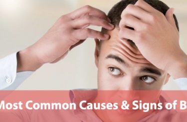 Most-Common-Causes-&-Signs-of-Balding3