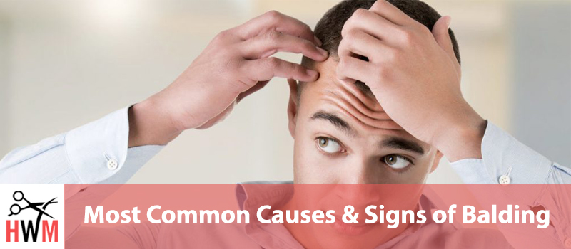 Most Common Causes & Signs of Balding