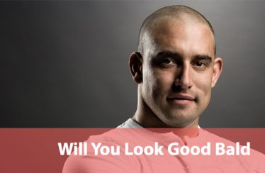 Will-You-Look-Good-Bald1