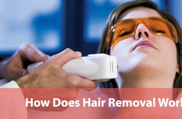 How-Does-Hair-Removal-Work