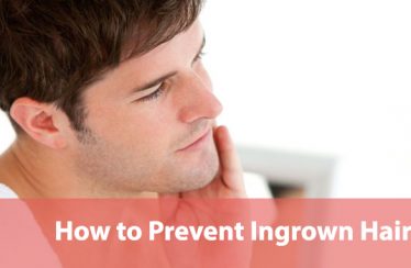 How-to-Prevent-Ingrown-Hairs