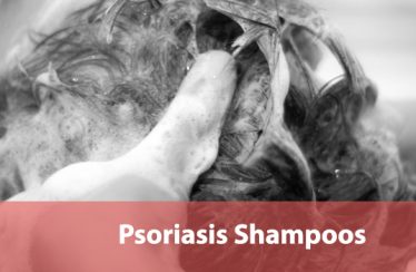 Best-Shampoos-for-Psoriasis