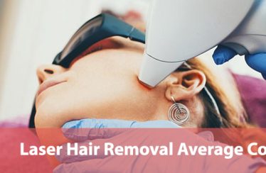 Average-Costs-of-Laser-Hair-Removal