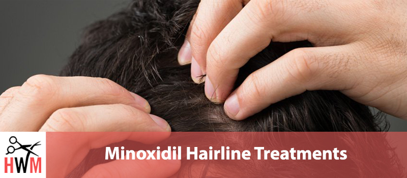 10 Best Minoxidil Hairline Treatments of 2019