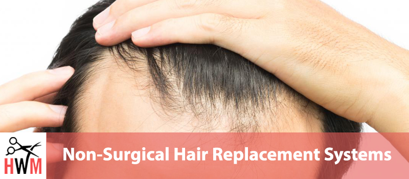 Non-Surgical Hair Replacement: Everything You’ll Ever Need to Know