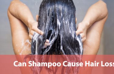 Can Shampoo Cause Hair Loss