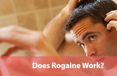 Does Rogaine Work