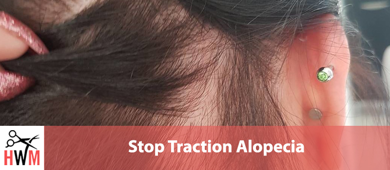 How to Stop Traction Alopecia