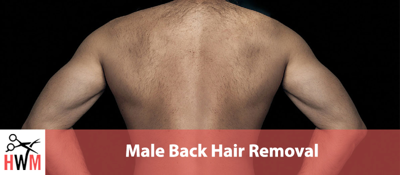 Best Male Back Hair Removal Options