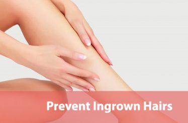 How to Prevent Ingrown Hairs