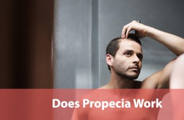 Does Propecia work