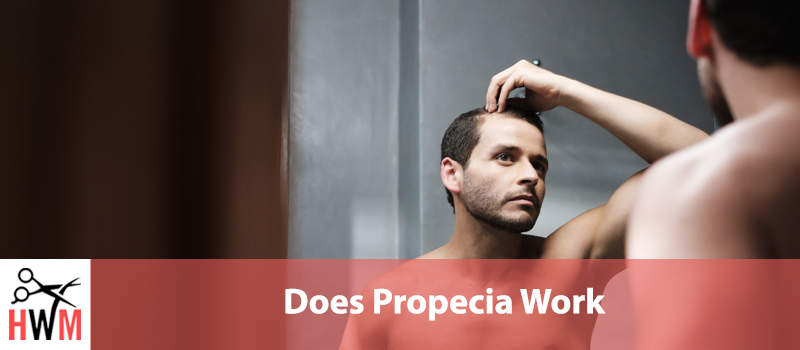 Does Propecia work