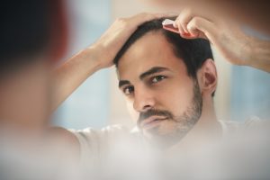 Minoxidil Treatments