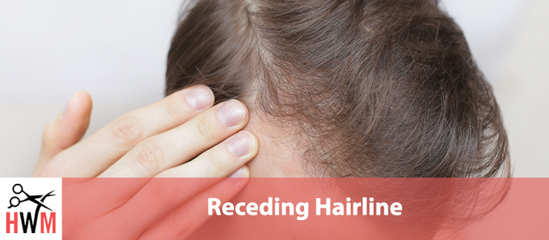 Receding Hairline