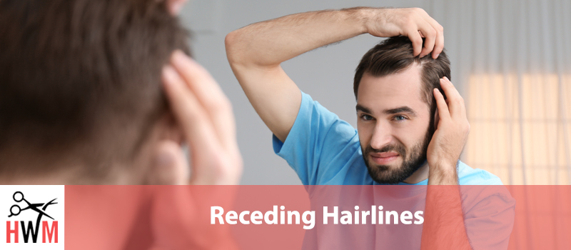 Receding Hairlines – What You Need to Know to Stop It