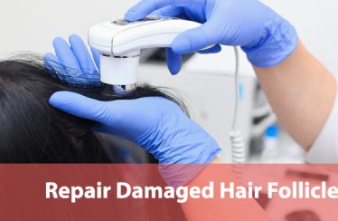 Repair Damaged Hair Follicles