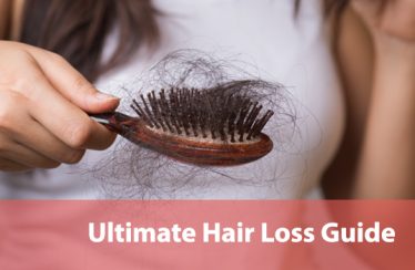 Ultimate Hair Loss Guide