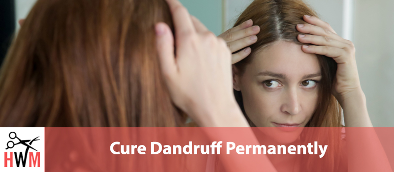 Cure-Dandruff-Permanently