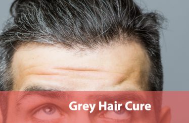 Grey-Hair-Cure