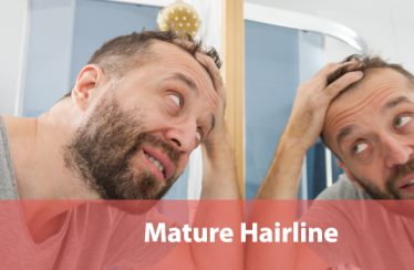 Mature Hairline