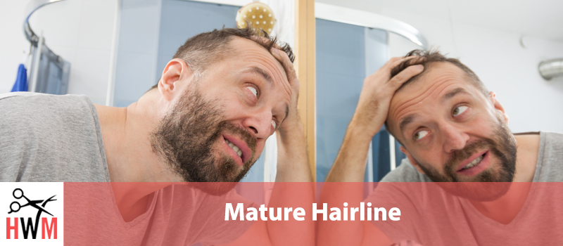 What is a Mature Hairline and What Does it Mean for You?