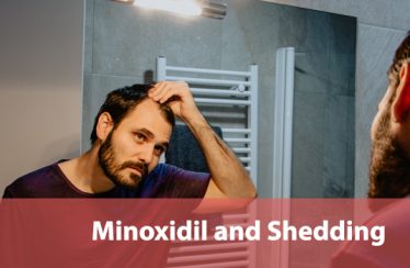 Minoxidil and Shedding