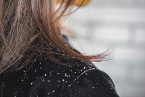 What Is Dandruff