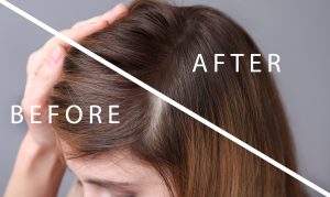 Improving Scalp Health