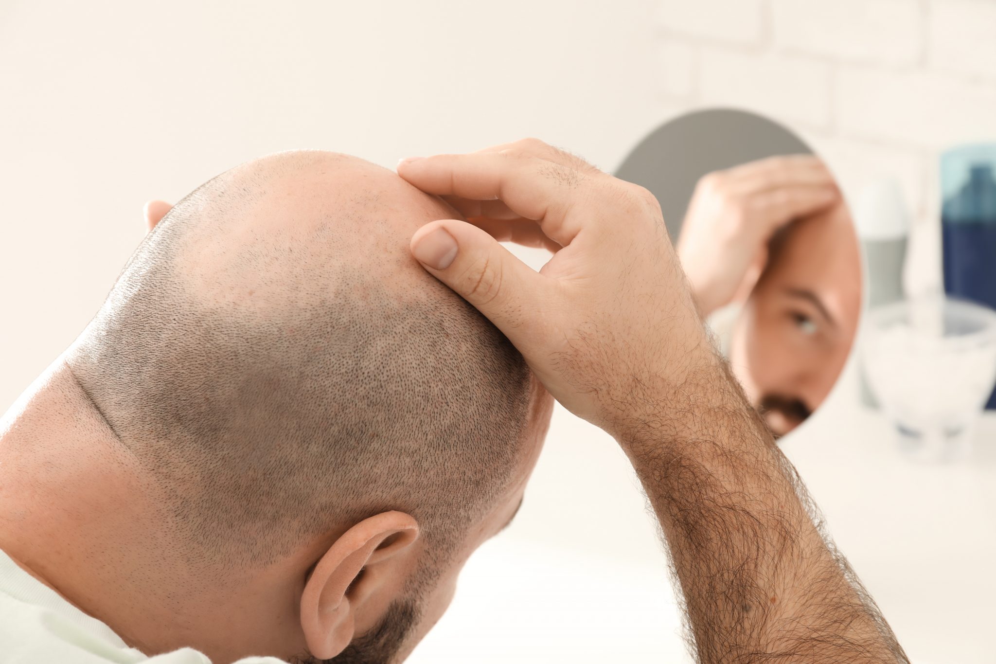 The Ultimate Guide to Hair Plugs, Implants, & Transplants Hair World