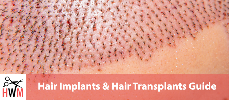 Guide-to-Hair-Plugs-Hair-Implants-&-Hair-Transplants