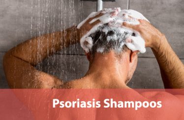 Best-Shampoos-for-Psoriasis